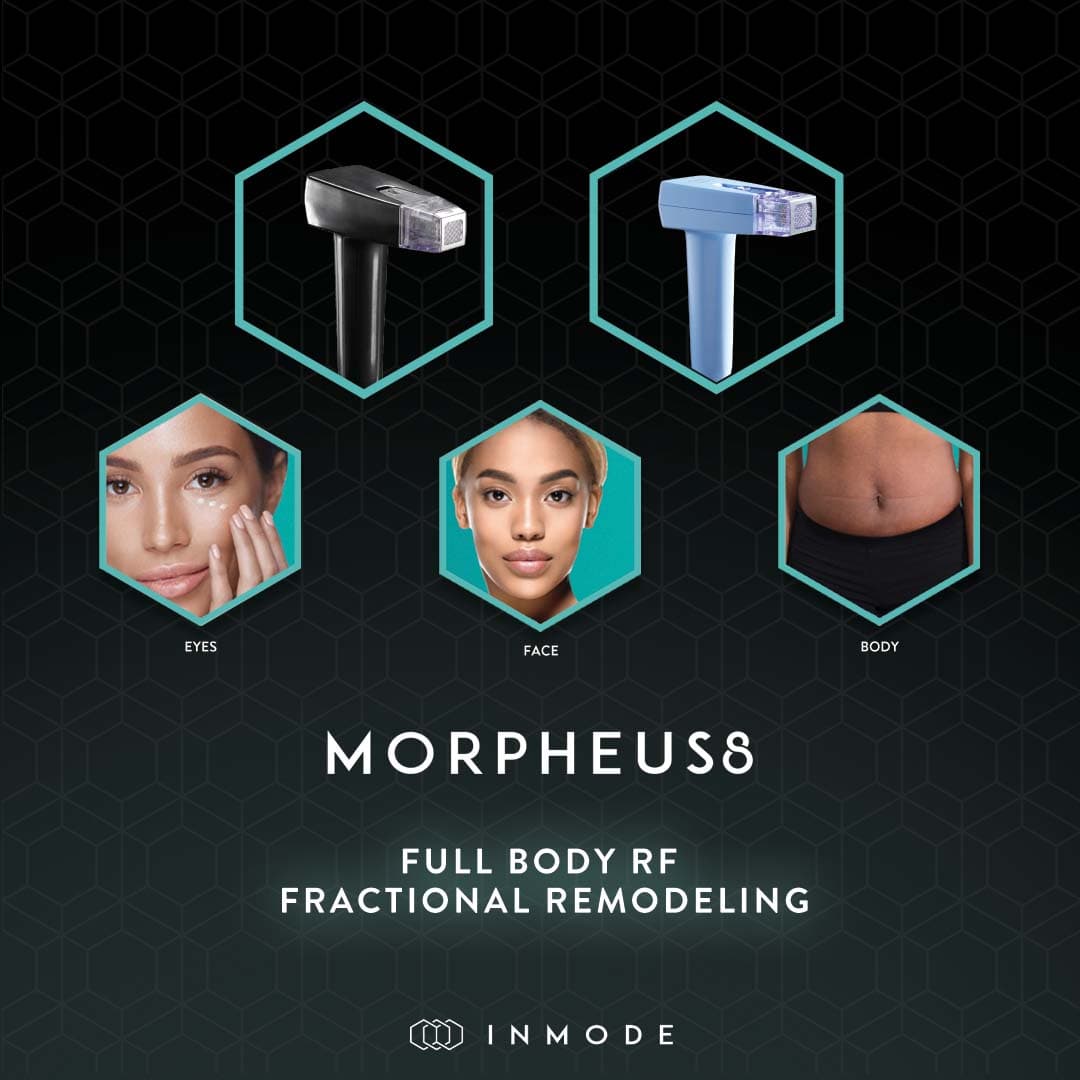 Morpheus8 treatment