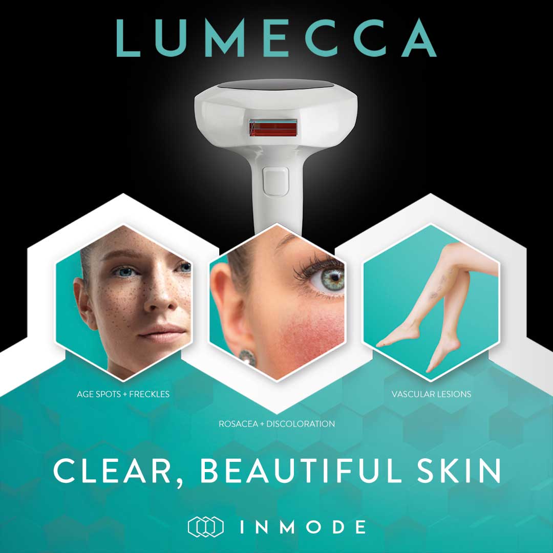 Lumecca treatment areas