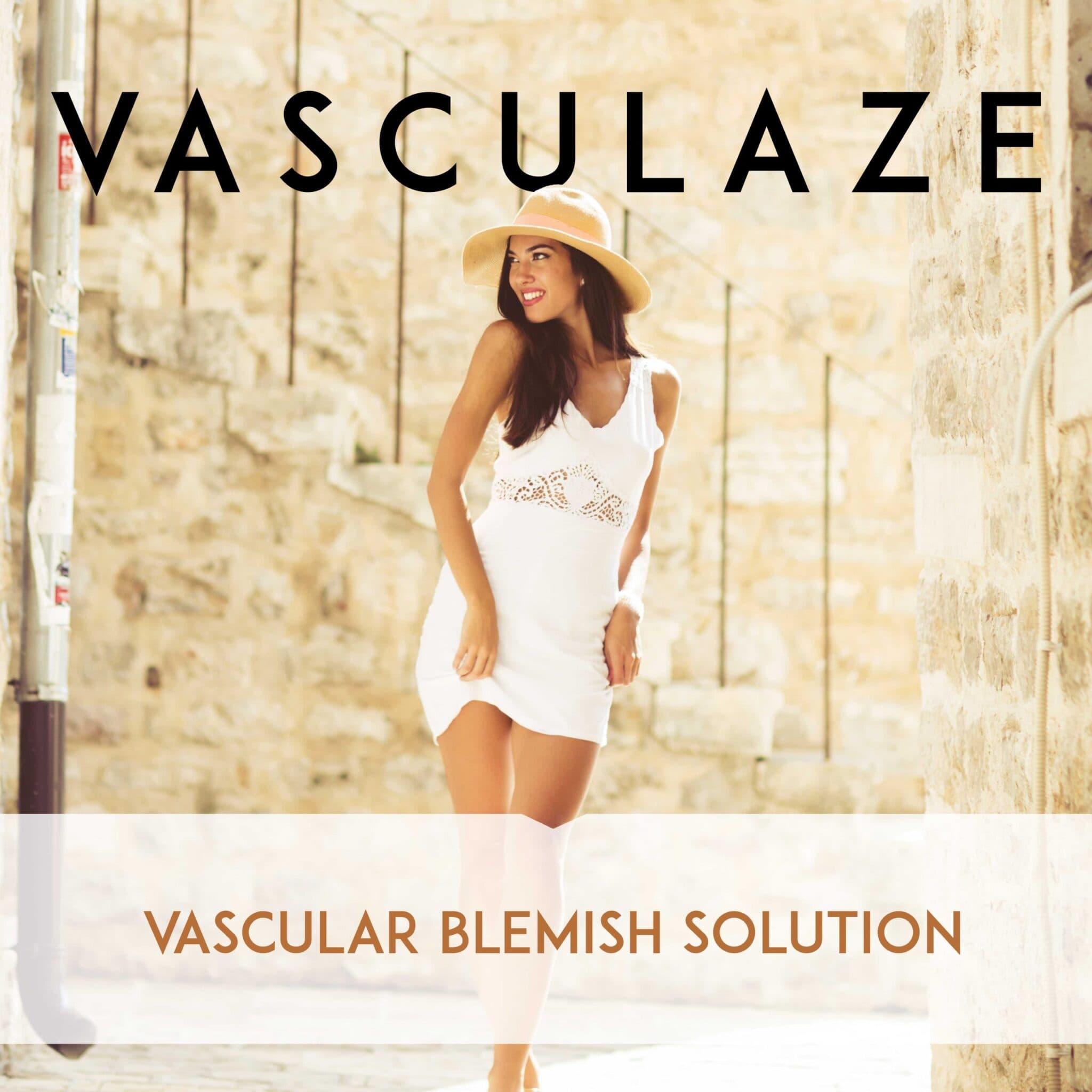 Spider vein treatment — 2